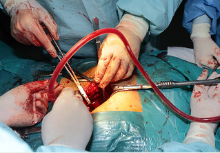 Best Urology Surgeon in Noida